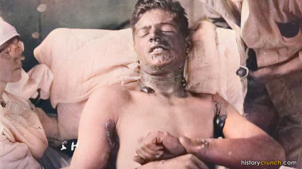 Poison Gas World War I