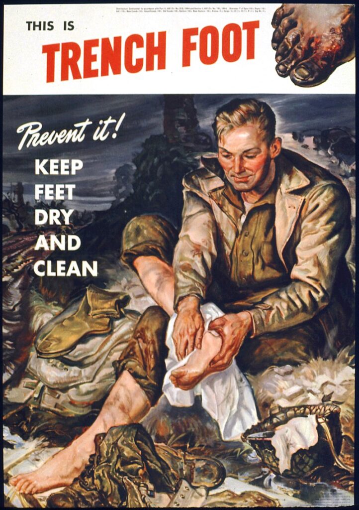 Trench Foot In World War I A Detailed Summary History Crunch Trench Foot In World War I A Detailed Summary History Crunch